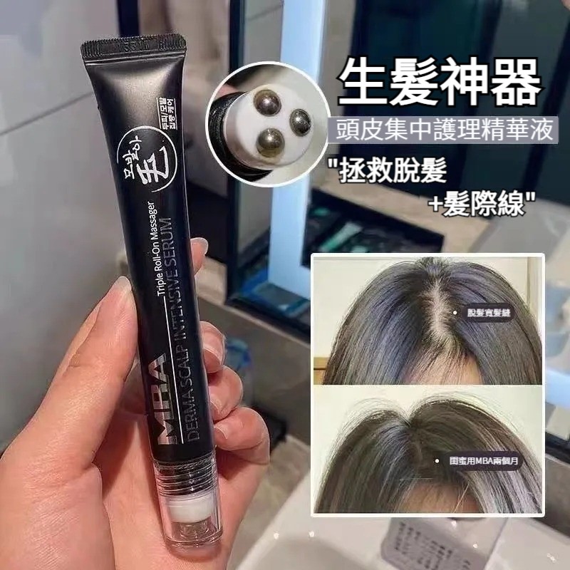 【生髮神器！頭髮生長增速40%！濃密度提升2倍！韓國超夯，拯救脫髮+髮際線，天然溫和草本，護理頭皮，喚醒毛囊，強韌髮根，不刺激頭皮！無副作用】韓國mba生髮液，正品滾珠防脫發，生發增發密發神器，拯救髮際線，男女增發液
